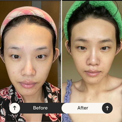 Eyebrow Regrowth Mask